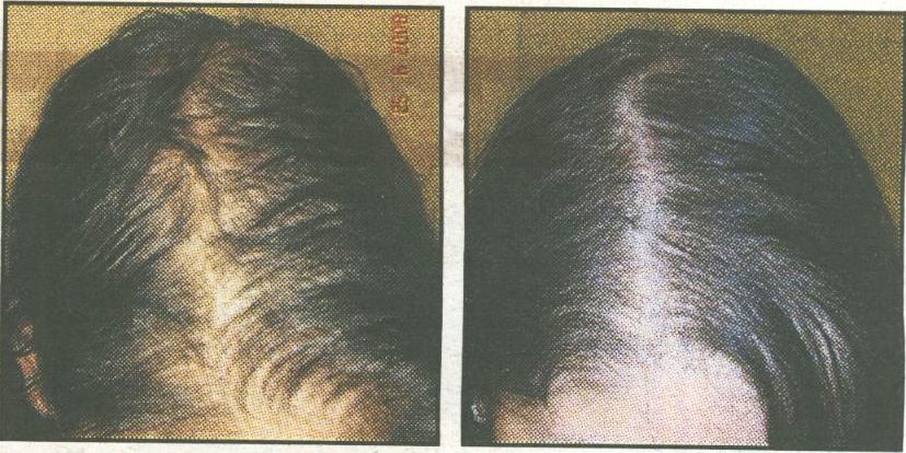 The "Central Bank Emo"